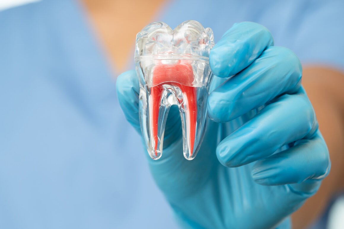 Endodoncia