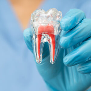 Endodoncia