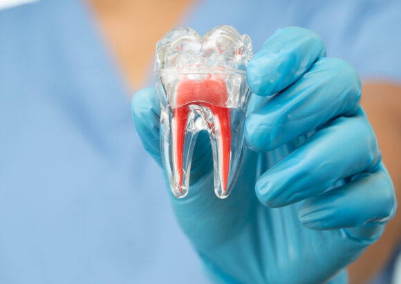 Endodoncia